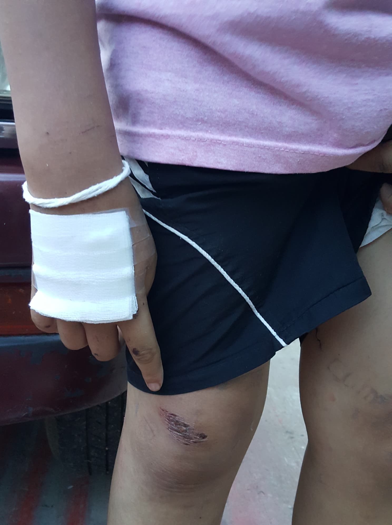 เหรียญประสบการณ์ เหรียญแอปเปิ้ล มหาเศรษฐี รุ่นแรก เนื้อทองฝาบาตรพระอาจารย์เหลย เตชะปัญโญ ปลุกเสกเดี่ยวอย่างข้มขลัง