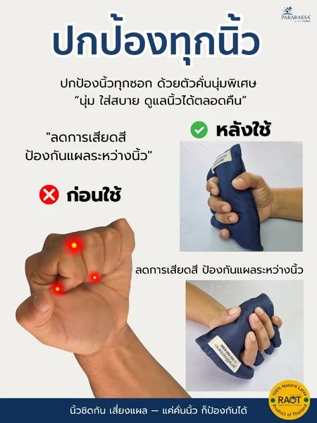 นวมแยกนิ้วผู้ป่วย ยางพาราธรรมชาติ 100% อุปกรณ์จัดท่ามือ ลดข้อนิ้วติด นิ้วล็อค ป้องกันแผลระหว่างนิ้ว สำหรับผู้สูงอายุ อัมพฤกษ์ อัมพาต image 4 นวมแยกนิ้วผู้ป่วย ยางพาราธรรมชาติ 100% อุปกรณ์จัดท่ามือ ลดข้อนิ้วติด นิ้วล็อค ป้องกันแผลระหว่างนิ้ว สำหรับผู้สูงอายุ อัมพฤกษ์ อัมพาต image 4