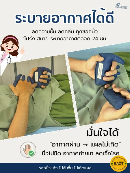 นวมแยกนิ้วผู้ป่วย ยางพาราธรรมชาติ 100% อุปกรณ์จัดท่ามือ ลดข้อนิ้วติด นิ้วล็อค ป้องกันแผลระหว่างนิ้ว สำหรับผู้สูงอายุ อัมพฤกษ์ อัมพาต image 5 นวมแยกนิ้วผู้ป่วย ยางพาราธรรมชาติ 100% อุปกรณ์จัดท่ามือ ลดข้อนิ้วติด นิ้วล็อค ป้องกันแผลระหว่างนิ้ว สำหรับผู้สูงอายุ อัมพฤกษ์ อัมพาต image 5