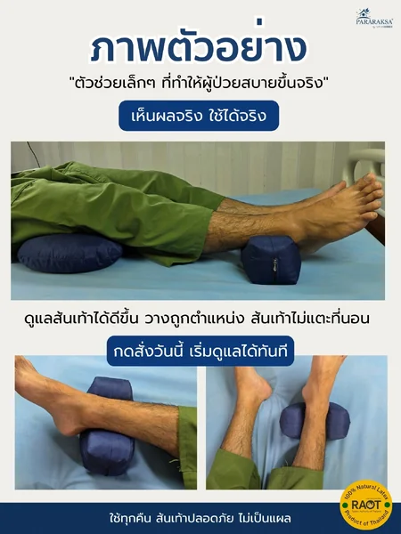 หมอนรองส้นเท้ายางพาราแท้ 100% ป้องกันแผลกดทับส้นเท้า สำหรับผู้ป่วยติดเตียง ผู้สูงอายุ ยกส้นเท้าลอย ลดแรงกด นอนนานไม่เจ็บ ซักได้ ขนาด: 8 x 19 x 9 ซม. น้ำหนัก: ประมาณ 200 กรัม จำนวน: 1 คู่ (ซ้าย/ขวา) image 7 หมอนรองส้นเท้ายางพาราแท้ 100% ป้องกันแผลกดทับส้นเท้า สำหรับผู้ป่วยติดเตียง ผู้สูงอายุ ยกส้นเท้าลอย ลดแรงกด นอนนานไม่เจ็บ ซักได้ ขนาด: 8 x 19 x 9 ซม. น้ำหนัก: ประมาณ 200 กรัม จำนวน: 1 คู่ (ซ้าย/ขวา) image 7