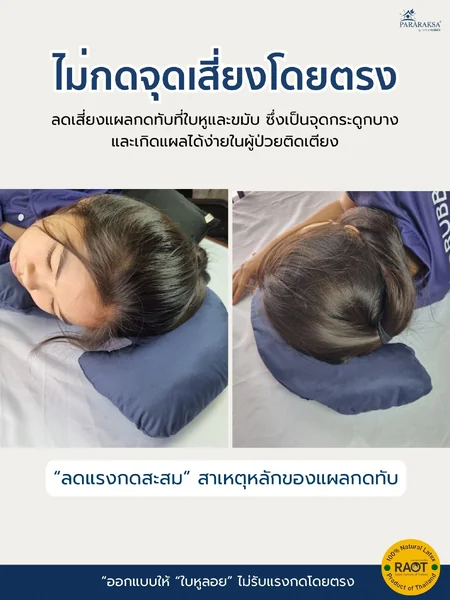 หมอนกันกดหูยางพาราแท้ 100% ทรง C ลดแผลกดทับใบหู สำหรับผู้ป่วยติดเตียง นอนตะแคงไม่เจ็บ ระบายอากาศดี ขนาด 38x27x11 ซม. น้ำหนัก 800 กรัม image 2 หมอนกันกดหูยางพาราแท้ 100% ทรง C ลดแผลกดทับใบหู สำหรับผู้ป่วยติดเตียง นอนตะแคงไม่เจ็บ ระบายอากาศดี ขนาด 38x27x11 ซม. น้ำหนัก 800 กรัม image 2
